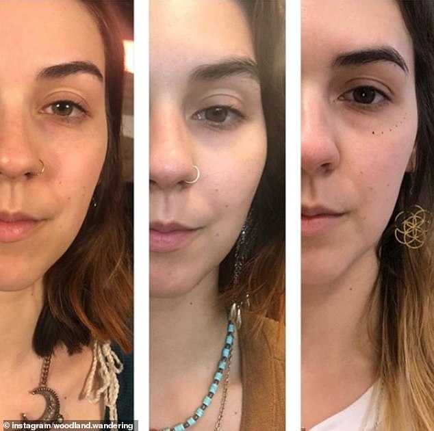 What Is Mewing? What Experts Think About the Jawline-Tightening Trick